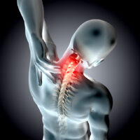 3D render of a medical  neck in pain